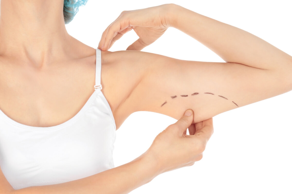 /images/procedures/arm-lift.jpg