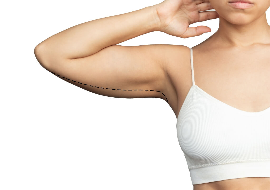 /images/procedures/breast-implants.jpg